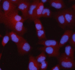 Immunofluorescent staining of STRBP using anti-STRBP antibody (red). STRBP was detected in an immunocytochemical section of HELA cells. Enzyme antigen retrieval was performed using IHC enzyme antigen retrieval reagent for 15 mins. The cells were blocked with 10% goat serum. And then incubated with 5 ug/ml rabbit anti-STRBP antibody overnight at 4oC. Cy3 Conjugated Goat Anti-Rabbit IgG was used as secondary antibody at 1:500 dilution and incubated for 30 minutes at 37oC. The section was counterstained with DAPI nuclear stain (blue). Visualize using a fluorescence microscope and filter sets appropriate for the label used.