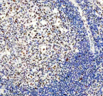 Immunohistochemical staining of TMC6 using anti-TMC6 antibody. TMC6 was detected in a paraffin-embedded section of human tonsil tissue. Heat mediated antigen retrieval was performed in EDTA buffer (pH 8.0, epitope retrieval solution). The tissue section was blocked with 10% goat serum. The tissue section was then incubated with 2 ug/ml rabbit anti-TMC6 antibody overnight at 4oC. Peroxidase Conjugated Goat Anti-rabbit IgG was used as secondary antibody and incubated for 30 minutes at 37oC. The tissue section was developed using an HRP secondary and DAB substrate.