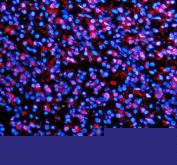 Immunofluorescent staining of TMC6 using anti-TMC6 antibody (red). TMC6 was detected in a paraffin-embedded section of human spleen tissue. Heat mediated antigen retrieval was performed in EDTA buffer (pH 8.0, epitope retrieval solution). The tissue section was blocked with 10% goat serum. The tissue section was then incubated with 5 ug/ml rabbit anti-TMC6 antibody overnight at 4oC. Cy3 Conjugated Goat Anti-Rabbit IgG was used as secondary antibody at 1:500 dilution and incubated for 30 minutes at 37oC. The section was counterstained with DAPI nuclear stain (blue). Visualize using a fluorescence microscope and filter sets appropriate for the label used.
