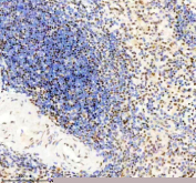 Immunohistochemical staining of TMC6 using anti-TMC6 antibody. TMC6 was detected in a paraffin-embedded section of human spleen tissue. Heat mediated antigen retrieval was performed in EDTA buffer (pH 8.0, epitope retrieval solution). The tissue section was blocked with 10% goat serum. The tissue section was then incubated with 2 ug/ml rabbit anti-TMC6 antibody overnight at 4oC. Peroxidase Conjugated Goat Anti-rabbit IgG was used as secondary antibody and incubated for 30 minutes at 37oC. The tissue section was developed using an HRP secondary and DAB substrate.