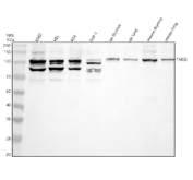 Western blot analysis of TMC6 using anti-TMC6 antibody. Electrophoresis was performed on a 10% SDS-PAGE gel at 80V (Stacking gel) / 120V (Resolving gel) for 2 hours. Lane 1: human K562 whole cell lysates, Lane 2: human HEL whole cell lysates, Lane 3: human RT4 whole cell lysates, Lane 4: human THP-1 whole cell lysates, Lane 5: rat thymus tissue lysates, Lane 6: rat lung tissue lysates, Lane 7: mouse thymus tissue lysates, Lane 8: mouse lung tissue lysates. After electrophoresis, proteins were transferred to a nitrocellulose membrane at 150 mA for 50-90 minutes. Blocked the membrane with 5% non-fat milk/TBS for 1.5 hour at RT. The membrane was incubated with rabbit anti-TMC6 antibody at 0.5 ug/ml overnight at 4oC, then washed with TBS-0.1%Tween 3 times with 5 minutes each and probed with a goat anti-rabbit IgG-HRP secondary antibody at a dilution of 1:5000 for 1.5 hour at RT. The signal was developed using an ECL Plus Western Blotting Substrate. TMC6 (EVER1, ~90 kDa predicted) was detected as doublets at ~100 and ~95 kDa, and additional ~85 kDa species in human cells, consistent with N-linked glycosylation, phosphorylation, and isoform variation. In mouse and rat tissues, a single ~100 kDa band predominated, reflecting the mature glycosylated form.