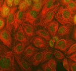 Immunofluorescent staining of TMC6 using anti-TMC6 antibody (green) and anti-Alpha Tubulin antibody (red). TMC6 was detected in an immunocytochemical section of Caco-2 cells. Enzyme antigen retrieval was performed using IHC enzyme antigen retrieval reagent for 15 mins. The cells were blocked with 10% goat serum. And then incubated with 5 ug/ml rabbit anti-TMC6 antibody and mouse anti-Beta Tubulin antibody overnight at 4oC. DyLight 488 Conjugated Goat Anti-Rabbit IgG and Cy3 Conjugated Goat Anti-Mouse IgG were used as secondary antibody at 1:500 dilution and incubated for 30 minutes at 37oC. Visualize using a fluorescence microscope and filter sets appropriate for the label used.