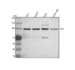 Western blot analysis of ACE2 using anti-ACE2 antibody. Lane 1: human Hela whole cell lysates, Lane 2: human HepG2 whole cell lysates, Lane 3: human K562 whole cell lysates, Lane 4: human CCRF-CEM whole cell lysates. After electrophoresis, proteins were transferred to a nitrocellulose membrane at 150 mA for 50-90 minutes. Blocked the membrane with 5% non-fat milk/TBS for 1.5 hour at RT. The membrane was incubated with rabbit anti-ACE2 antibody at 0.5 ug/ml overnight at 4oC, then washed with TBS-0.1%Tween 3 times with 5 minutes each and probed with a goat anti-rabbit IgG-HRP secondary antibody at a dilution of 1:5000 for 1.5 hour at RT. The signal was developed using enhanced chemiluminescent. The expected molecular weight of ACE2 is 90-100 kDa.