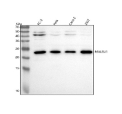 Western blot analysis of MALSU1 using anti-MALSU1 antibody. Lane 1: human PC-3 whole cell lysates, Lane 2: human Hela whole cell lysates, Lane 3: human Caco-2 whole cell lysates, Lane 4: human 293T whole cell lysates. After electrophoresis, proteins were transferred to a nitrocellulose membrane at 150 mA for 50-90 minutes. Blocked the membrane with 5% non-fat milk/TBS for 1.5 hour at RT. The membrane was incubated with rabbit anti-MALSU1 antibody at 0.5 ug/ml overnight at 4oC, then washed with TBS-0.1%Tween 3 times with 5 minutes each and probed with a goat anti-rabbit IgG-HRP secondary antibody at a dilution of 1:5000 for 1.5 hour at RT. The signal was developed using enhanced chemiluminescent. The expected molecular weight of MALSU1 is ~26 kDa.