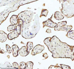 Immunohistochemical staining of MALSU1 using anti-MALSU1 antibody. MALSU1 was detected in a paraffin-embedded section of human placenta tissue. Heat mediated antigen retrieval was performed in EDTA buffer (pH 8.0, epitope retrieval solution). The tissue section was blocked with 10% goat serum. The tissue section was then incubated with 2 ug/ml rabbit anti-MALSU1 antibody overnight at 4oC. Peroxidase Conjugated Goat Anti-rabbit IgG was used as secondary antibody and incubated for 30 minutes at 37oC. The tissue section was developed using an HRP secondary and DAB substrate.