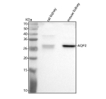 Western blot analysis of Aqp2 using anti-Aqp2 antibody. Lane 1: rat kidney tissue lysates, Lane 2: mouse kidney tissue lysates. After electrophoresis, proteins were transferred to a nitrocellulose membrane at 150 mA for 50-90 minutes. Blocked the membrane with 5% non-fat milk/TBS for 1.5 hour at RT. The membrane was incubated with rabbit anti-Aqp2 antibody at 0.5 ug/ml overnight at 4oC, then washed with TBS-0.1%Tween 3 times with 5 minutes each and probed with a goat anti-rabbit IgG-HRP secondary antibody at a dilution of 1:5000 for 1.5 hour at RT. The signal was developed using enhanced chemiluminescent. The protein is routinely visualized from 29-46 kDa depending on glycosylation level.