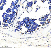 Immunohistochemical staining of DOCK8 using anti-DOCK8 antibody. DOCK8 was detected in a paraffin-embedded section of mouse bone marrow tissue. Heat mediated antigen retrieval was performed in EDTA buffer (pH 8.0, epitope retrieval solution). The tissue section was blocked with 10% goat serum. The tissue section was then incubated with 2 ug/ml rabbit anti-DOCK8 antibody overnight at 4oC. Peroxidase Conjugated Goat Anti-rabbit IgG was used as secondary antibody and incubated for 30 minutes at 37oC. The tissue section was developed using an HRP secondary and DAB substrate.