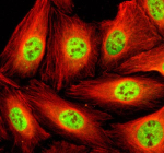 Immunofluorescent staining of STK33 using anti-STK33 antibody (green) and anti-Beta Tubulin antibody (red). STK33 was detected in an immunocytochemical section of U2OS cells. Enzyme antigen retrieval was performed using IHC enzyme antigen retrieval reagent for 15 mins. The cells were blocked with 10% goat serum. And then incubated with 5 ug/ml rabbit anti-STK33 antibody and mouse anti-Beta Tubulin antibody overnight at 4oC. DyLight 488 Conjugated Goat Anti-Rabbit IgG and Cy3 Conjugated Goat Anti-Mouse IgG were used as secondary antibody at 1:500 dilution and incubated for 30 minutes at 37oC. Visualize using a fluorescence microscope and filter sets appropriate for the label used.