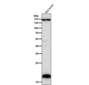 All lanes use the Pleiotrophin antibody at 1:5K dilution for 1 hour at room temperature. Predicted molecular weight ~19 kDa.