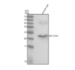 Western blot analysis of Retinoschisin using anti-Retinoschisin antibody. Lane 1: mouse eye tissue lysates. After electrophoresis, proteins were transferred to a nitrocellulose membrane at 150 mA for 50-90 minutes. Blocked the membrane with 5% non-fat milk/TBS for 1.5 hour at RT. The membrane was incubated with rabbit anti-Retinoschisin antibody at 0.5 ug/ml overnight at 4oC, then washed with TBS-0.1%Tween 3 times with 5 minutes each and probed with a goat anti-rabbit IgG-HRP secondary antibody at a dilution of 1:5000 for 1.5 hour at RT. The signal was developed using enhanced chemiluminescent. The expected molecular weight of RS1 is ~25 kDa.