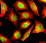 Immunofluorescent staining of NUP160 using anti-NUP160 antibody (green) and anti-Beta Tubulin antibody (red). NUP160 was detected in an immunocytochemical section of Hela cells. Enzyme antigen retrieval was performed using IHC enzyme antigen retrieval reagent for 15 mins. The cells were blocked with 10% goat serum. And then incubated with 5 ug/ml rabbit anti-NUP160 antibody and mouse anti-Beta Tubulin antibody overnight at 4oC. DyLight 488 Conjugated Goat Anti-Rabbit IgG and Cy3 Conjugated Goat Anti-Mouse IgG were used as secondary antibody at 1:500 dilution and incubated for 30 minutes at 37oC. Visualize using a fluorescence microscope and filter sets appropriate for the label used.