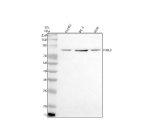 Western blot analysis of NOL9 using anti-NOL9 antibody. Lane 1: human HepG2 whole cell lysates, Lane 2: human PC-3 whole cell lysates, Lane 3: human Hela whole cell lysates. After electrophoresis, proteins were transferred to a nitrocellulose membrane at 150 mA for 50-90 minutes. Blocked the membrane with 5% non-fat milk/TBS for 1.5 hour at RT. The membrane was incubated with rabbit anti-NOL9 antibody at 0.5 ug/ml overnight at 4oC, then washed with TBS-0.1%Tween 3 times with 5 minutes each and probed with a goat anti-rabbit IgG-HRP secondary antibody at a dilution of 1:5000 for 1.5 hour at RT. The signal was developed using enhanced chemiluminescent. The expected molecular weight of NOL9 is ~79 kDa.