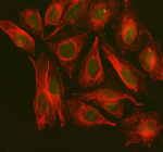 Immunofluorescent staining of NOL9 using anti-NOL9 antibody (green) and anti-Beta Tubulin antibody (red). NOL9 was detected in an immunocytochemical section of U2OS cells. Enzyme antigen retrieval was performed using IHC enzyme antigen retrieval reagent for 15 mins. The cells were blocked with 10% goat serum. And then incubated with 5 ug/ml rabbit anti-NOL9 antibody and mouse anti-Beta Tubulin antibody overnight at 4oC. DyLight 488 Conjugated Goat Anti-Rabbit IgG and DyLight 594 Conjugated Goat Anti-Mouse IgG were used as secondary antibody at 1:500 dilution and incubated for 30 minutes at 37oC. Visualize using a fluorescence microscope and filter sets appropriate for the label used.