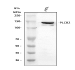 Western blot analysis of PLCB2 using anti-PLCB2 antibody. Lane 1: human HEL whole cell lysates. After electrophoresis, proteins were transferred to a nitrocellulose membrane at 150 mA for 50-90 minutes. Blocked the membrane with 5% non-fat milk/TBS for 1.5 hour at RT. The membrane was incubated with rabbit anti-PLCB2 antibody at 0.5 ug/ml overnight at 4oC, then washed with TBS-0.1%Tween 3 times with 5 minutes each and probed with a goat anti-rabbit IgG-HRP secondary antibody at a dilution of 1:5000 for 1.5 hour at RT. The signal was developed using enhanced chemiluminescent. PLCB2 (~134 kDa predicted) was detected as a doublet at ~135-145 kDa, consistent with phosphorylation-dependent mobility shifts and isoform variation reported for this enzyme.