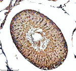 Immunohistochemical staining of SPATA6 using anti-SPATA6 antibody. SPATA6 was detected in a paraffin-embedded section of rat testis tissue. Heat mediated antigen retrieval was performed in EDTA buffer (pH 8.0, epitope retrieval solution). The tissue section was blocked with 10% goat serum. The tissue section was then incubated with 2 ug/ml rabbit anti-SPATA6 antibody overnight at 4oC. Peroxidase Conjugated Goat Anti-rabbit IgG was used as secondary antibody and incubated for 30 minutes at 37oC. The tissue section was developed using an HRP secondary and DAB substrate.