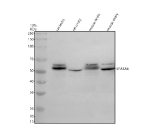 Western blot analysis of SPATA6 using anti-SPATA6 antibody. Electrophoresis was performed on a 10% SDS-PAGE gel at 80V (Stacking gel) / 120V (Resolving gel) for 2 hours. Lane 1: rat testis tissue lysates, Lane 2: rat ovary tissue lysates, Lane 3: mouse testis tissue lysates, Lane 4: mouse ovary tissue lysates. After electrophoresis, proteins were transferred to a nitrocellulose membrane at 150 mA for 50-90 minutes. Blocked the membrane with 5% non-fat milk/TBS for 1.5 hour at RT. The membrane was incubated with rabbit anti-SPATA6 antibody at 0.5 ug/ml overnight at 4oC, then washed with TBS-0.1%Tween 3 times with 5 minutes each and probed with a goat anti-rabbit IgG-HRP secondary antibody at a dilution of 1:5000 for 1.5 hour at RT. The signal was developed using an ECL Plus Western Blotting Substrate. SPATA6 (~52 kDa predicted) was detected as a doublet at ~50-55 kDa in rat and mouse testis, consistent with phosphorylated and unphosphorylated forms reported in germ cell studies.
