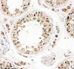 Immunohistochemical staining of TTLL1 using anti-TTLL1 antibody. TTLL1 was detected in a paraffin-embedded section of human testis tissue. Heat mediated antigen retrieval was performed in EDTA buffer (pH 8.0, epitope retrieval solution). The tissue section was blocked with 10% goat serum. The tissue section was then incubated with 2 ug/ml rabbit anti-TTLL1 antibody overnight at 4oC. Peroxidase Conjugated Goat Anti-rabbit IgG was used as secondary antibody and incubated for 30 minutes at 37oC. The tissue section was developed using an HRP secondary and DAB substrate.