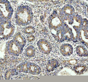 Immunohistochemical staining of OMA1 using anti-OMA1 antibody. OMA1 was detected in a paraffin-embedded section of human colon cancer tissue. Heat mediated antigen retrieval was performed in EDTA buffer (pH 8.0, epitope retrieval solution). The tissue section was blocked with 10% goat serum. The tissue section was then incubated with 2 ug/ml rabbit anti-OMA1 antibody overnight at 4oC. Peroxidase Conjugated Goat Anti-rabbit IgG was used as secondary antibody and incubated for 30 minutes at 37oC. The tissue section was developed using an HRP secondary and DAB substrate.