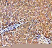 Immunohistochemical staining of TRIM59 using anti-TRIM59 antibody. TRIM59 was detected in a paraffin-embedded section of human liver tissue. Heat mediated antigen retrieval was performed in EDTA buffer (pH 8.0, epitope retrieval solution). The tissue section was blocked with 10% goat serum. The tissue section was then incubated with 2 ug/ml rabbit anti-TRIM59 antibody overnight at 4oC. Peroxidase Conjugated Goat Anti-rabbit IgG was used as secondary antibody and incubated for 30 minutes at 37oC. The tissue section was developed using an HRP secondary and DAB substrate.