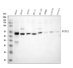 Western blot analysis of FOXC2 using anti-FOXC2 antibody. Electrophoresis was performed on a 10% SDS-PAGE gel at 80V (Stacking gel) / 120V (Resolving gel) for 2 hours. Lane 1: human Hela whole cell lysates, Lane 2: human 293T whole cell lysates, Lane 3: human whole cell lysates, Lane 4: human PC-3 whole cell lysates, Lane 5: rat PC-12 whole cell lysates, Lane 6: rat NRK whole cell lysates, Lane 7: mouse C2C12 whole cell lysates, Lane 8: mouse 3T3-L1 whole cell lysates. After electrophoresis, proteins were transferred to a nitrocellulose membrane at 150 mA for 50-90 minutes. Blocked the membrane with 5% non-fat milk/TBS for 1.5 hour at RT. The membrane was incubated with rabbit anti-FOXC2 antibody at 0.5 ug/ml overnight at 4oC, then washed with TBS-0.1%Tween 3 times with 5 minutes each and probed with a goat anti-rabbit IgG-HRP secondary antibody at a dilution of 1:5000 for 1.5 hour at RT. The signal is developed using an ECL Plus Western Blotting Substratewith Tanon 5200 system. FOXC2 (~54 kDa predicted) was detected at ~58-60 kDa, consistent with phosphorylation- and SUMOylation-dependent mobility shifts reported for this transcription factor