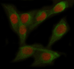 Immunofluorescent staining of FOXC2 using anti-FOXC2 antibody (red) and anti-Tubulin Alpha antibody (green). FOXC2 was detected in immunocytochemical section of Hela cell. Enzyme antigen retrieval was performed using IHC enzyme antigen retrieval reagent for 15 mins. The cells were blocked with 10% goat serum. And then incubated with 5 ug/ml rabbit anti-FOXC2 antibody and mouse anti-Tubulin Alpha antibody overnight at 4oC. Cy3 Conjugated Goat Anti-Rabbit IgG and FITC Conjugated Goat Anti-Mouse IgG were used as secondary antibody at 1:500 dilution and incubated for 30 minutes at 37oC. Visualize using a fluorescence microscope and filter sets appropriate for the label used.