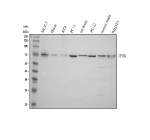 Western blot analysis of TPBG using anti-TPBG antibody. Electrophoresis was performed on a 10% SDS-PAGE gel at 80V (Stacking gel) / 120V (Resolving gel) for 2 hours. Lane 1: human MCF-7 whole cell lysates, Lane 2: human Hacat whole cell lysates, Lane 3: human RT4 whole cell lysates, Lane 4: human PC-3 whole cell lysates, Lane 5: rat brain tissue lysates, Lane 6: rat PC-12 whole cell lysates, Lane 7: mouse brain tissue lysates, Lane 8: mouse NIH/3T3 whole cell lysates. After electrophoresis, proteins were transferred to a nitrocellulose membrane at 150 mA for 50-90 minutes. Blocked the membrane with 5% non-fat milk/TBS for 1.5 hour at RT. The membrane was incubated with rabbit anti-TPBG antibody at 0.5 ug/ml overnight at 4oC, then washed with TBS-0.1%Tween 3 times with 5 minutes each and probed with a goat anti-rabbit IgG-HRP secondary antibody at a dilution of 1:5000 for 1.5 hour at RT. The signal was developed using an ECL Plus Western Blotting Substrate. TPBG (~45 kDa predicted) was detected primarily at ~70-80 kDa, consistent with extensive N-linked glycosylation of the extracellular domain. A faint higher band (~90-100 kDa) likely represents a hyper-glycosylated variant of TPBG, as previously reported for the trophoblast glycoprotein 5T4.