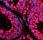 Immunofluorescent staining of TFDP3 using anti-TFDP3 antibody  (red). TFDP3 was detected in a paraffin-embedded section of human testis tissue. Heat mediated antigen retrieval was performed in EDTA buffer (pH 8.0, epitope retrieval solution). The tissue section was blocked with 10% goat serum. The tissue section was then incubated with 5 ug/ml rabbit anti-TFDP3 antibody overnight at 4oC. Cy3 Conjugated Goat Anti-Rabbit IgG was used as secondary antibody at 1:500 dilution and incubated for 30 minutes at 37oC. The section was counterstained with DAPI nuclear stain (blue). Visualize using a fluorescence microscope and filter sets appropriate for the label used.