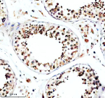 Immunohistochemical staining of TFDP3 using anti-TFDP3 antibody. TFDP3 was detected in a paraffin-embedded section of human testis tissue. Heat mediated antigen retrieval was performed in EDTA buffer (pH 8.0, epitope retrieval solution). The tissue section was blocked with 10% goat serum. The tissue section was then incubated with 2 ug/ml rabbit anti-TFDP3 antibody overnight at 4oC. Peroxidase Conjugated Goat Anti-rabbit IgG was used as secondary antibody and incubated for 30 minutes at 37oC. The tissue section was developed using an HRP secondary and DAB substrate.