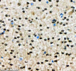 Immunohistochemical staining of SALL2 using anti-SALL2 antibody. SALL2 was detected in a paraffin-embedded section of mouse brain tissue. Heat mediated antigen retrieval was performed in EDTA buffer (pH 8.0, epitope retrieval solution). The tissue section was blocked with 10% goat serum. The tissue section was then incubated with 2 ug/ml rabbit anti-SALL2 antibody overnight at 4oC. Peroxidase Conjugated Goat Anti-rabbit IgG was used as secondary antibody and incubated for 30 minutes at 37oC. The tissue section was developed using an HRP secondary and DAB substrate.