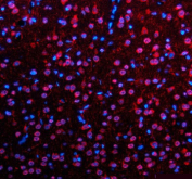 Immunofluorescent staining of SALL2 using anti-SALL2 antibody (red). SALL2 was detected in a paraffin-embedded section of rat brain tissue. Heat mediated antigen retrieval was performed in EDTA buffer (pH 8.0, epitope retrieval solution). The tissue section was blocked with 10% goat serum. The tissue section was then incubated with 5 ug/ml rabbit anti-SALL2 antibody overnight at 4oC. Cy3 Conjugated Goat Anti-Rabbit IgG was used as secondary antibody at 1:500 dilution and incubated for 30 minutes at 37oC. The section was counterstained with DAPI nuclear stain (blue). Visualize using a fluorescence microscope and filter sets appropriate for the label used.