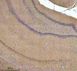 Immunohistochemical staining of SALL2 using anti-SALL2 antibody. SALL2 was detected in a paraffin-embedded section of rat brain tissue. Heat mediated antigen retrieval was performed in EDTA buffer (pH 8.0, epitope retrieval solution). The tissue section was blocked with 10% goat serum. The tissue section was then incubated with 2 ug/ml rabbit anti-SALL2 antibody overnight at 4oC. Peroxidase Conjugated Goat Anti-rabbit IgG was used as secondary antibody and incubated for 30 minutes at 37oC. The tissue section was developed using an HRP secondary and DAB substrate.