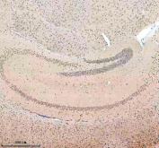 Immunohistochemical staining of SALL2 using anti-SALL2 antibody. SALL2 was detected in a paraffin-embedded section of mouse brain tissue. Heat mediated antigen retrieval was performed in EDTA buffer (pH 8.0, epitope retrieval solution). The tissue section was blocked with 10% goat serum. The tissue section was then incubated with 2 ug/ml rabbit anti-SALL2 antibody overnight at 4oC. Peroxidase Conjugated Goat Anti-rabbit IgG was used as secondary antibody and incubated for 30 minutes at 37oC. The tissue section was developed using an HRP secondary and DAB substrate.
