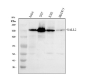 Western blot analysis of SALL2 using anti-SALL2 antibody. Electrophoresis was performed on a 8% SDS-PAGE gel at 80V (Stacking gel) / 120V (Resolving gel) for 2 hours. Lane 1: human Jurkat whole cell lysates, Lane 2: human 293T whole cell lysates, Lane 3: human K562 whole cell lysates, Lane 4: human SH-SY5Y whole cell lysates. After electrophoresis, proteins were transferred to a nitrocellulose membrane at 150 mA for 50-90 minutes. Blocked the membrane with 5% non-fat milk/TBS for 1.5 hour at RT. The membrane was incubated with rabbit anti-SALL2 antibody at 0.5 ug/ml overnight at 4oC, then washed with TBS-0.1%Tween 3 times with 5 minutes each and probed with a goat anti-rabbit IgG-HRP secondary antibody at a dilution of 1:5000 for 1.5 hour at RT. The signal was developed using an ECL Plus Western Blotting Substrate. A prominent band was detected at approximately 150 kDa, which is higher than the predicted molecular weight (~105 kDa). This upshifted migration is consistent with published reports describing SALL2 (also referred to as p150 (Sal2)) as a ~150 kDa protein in human and ovarian carcinoma cells, likely reflecting isoform variation or post-translational modification.