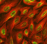 Immunofluorescent staining of SALL2 using anti-SALL2 antibody (green) and anti-Beta Tubulin antibody (red). SALL2 was detected in an immunocytochemical section of U2OS cells. Enzyme antigen retrieval was performed using IHC enzyme antigen retrieval reagent for 15 mins. The cells were blocked with 10% goat serum. And then incubated with 5 ug/ml rabbit anti-SALL2 antibody and mouse anti-Beta Tubulin antibody overnight at 4oC. DyLight 488 Conjugated Goat Anti-Rabbit IgG and Cy3 Conjugated Goat Anti-Mouse IgG were used as secondary antibody at 1:500 dilution and incubated for 30 minutes at 37oC. Visualize using a fluorescence microscope and filter sets appropriate for the label used.