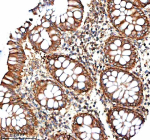 Immunohistochemical staining of IVNS1ABP using anti-IVNS1ABP antibody. IVNS1ABP was detected in a paraffin-embedded section of human colon tissue. Heat mediated antigen retrieval was performed in EDTA buffer (pH 8.0, epitope retrieval solution). The tissue section was blocked with 10% goat serum. The tissue section was then incubated with 2 ug/ml rabbit anti-IVNS1ABP antibody overnight at 4oC. Peroxidase Conjugated Goat Anti-rabbit IgG was used as secondary antibody and incubated for 30 minutes at 37oC. The tissue section was developed using an HRP secondary and DAB substrate.