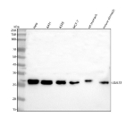 Western blot analysis of Galectin-3/LGALS3 using anti-LGALS3 antibody. Lane 1: human Hela whole cell lysates, Lane 2: human whole cell lysates, Lane 3: human whole cell lysates, Lane 4: human MCF-7 whole cell lysates, Lane 5: rat stomach tissue lysates, Lane 6: mouse stomach tissue lysates. After electrophoresis, proteins were transferred to a nitrocellulose membrane at 150 mA for 50-90 minutes. Blocked the membrane with 5% non-fat milk/TBS for 1.5 hour at RT. The membrane was incubated with rabbit anti-LGALS3 antibody at 0.5 ug/ml overnight at 4oC, then washed with TBS-0.1%Tween 3 times with 5 minutes each and probed with a goat anti-rabbit IgG-HRP secondary antibody at a dilution of 1:5000 for 1.5 hour at RT. The signal was developed using enhanced chemiluminescent. The expected molecular weight of Galectin-3/LGALS3 is at 26 kDa.