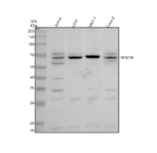 Western blot analysis of TRIM39 using anti-TRIM39 antibody. Electrophoresis was performed on a 10% SDS-PAGE gel at 80V (Stacking gel) / 120V (Resolving gel) for 2 hours. Lane 1: human Jurkat whole cell lysates, Lane 2: human U251 whole cell lysates, Lane 3: human MCF-7 whole cell lysates, Lane 4: human Caco-2 whole cell lysates. After electrophoresis, proteins were transferred to a nitrocellulose membrane at 150 mA for 50-90 minutes. Blocked the membrane with 5% non-fat milk/TBS for 1.5 hour at RT. The membrane was incubated with rabbit anti-TRIM39 antibody at 0.5 ug/ml overnight at 4oC, then washed with TBS-0.1%Tween 3 times with 5 minutes each and probed with a goat anti-rabbit IgG-HRP secondary antibody at a dilution of 1:5000 for 1.5 hour at RT. The signal was developed using an ECL Plus Western Blotting Substrate. TRIM39 (~60 kDa predicted) was detected as a dominant band migrating just under ~70 kDa with nearby additional bands. This upward shift and band heterogeneity are consistent with the presence of TRIM39 isoforms and post-translational modification of this RING E3 ligase, which can alter electrophoretic mobility