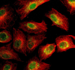 Immunofluorescent staining of SIGLEC15 using anti-SIGLEC15 antibody (green) and anti-Beta Tubulin antibody (red). SIGLEC15 was detected in an immunocytochemical section of cells. Enzyme antigen retrieval was performed using IHC enzyme antigen retrieval reagent for 15 mins. The cells were blocked with 10% goat serum. And then incubated with 5 ug/ml rabbit anti-SIGLEC15 antibody and mouse anti-Beta Tubulin antibody overnight at 4oC. DyLight 488 Conjugated Goat Anti-Rabbit IgG and Cy3 Conjugated Goat Anti-Mouse IgG were used as secondary antibody at 1:500 dilution and incubated for 30 minutes at 37oC. Visualize using a fluorescence microscope and filter sets appropriate for the label used.