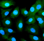 Immunofluorescent staining of RBCK1 using anti-RBCK1 antibody. RBCK1 was detected in an immunocytochemical section of cells. Enzyme antigen retrieval was performed using IHC enzyme antigen retrieval reagent for 15 mins. The cells were blocked with 10% goat serum. And then incubated with 5 ug/ml rabbit anti-RBCK1 antibody overnight at 4oC. DyLight 488 Conjugated Goat Anti-Rabbit IgG was used as secondary antibody at 1:500 dilution and incubated for 30 minutes at 37oC. The section was counterstained with DAPI nuclear stain (blue). Visualize using a fluorescence microscope and filter sets appropriate for the label used.