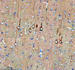 Immunohistochemical staining of MARCKS using anti-MARCKS antibody. MARCKS was detected in a paraffin-embedded section of rat brain tissue. Heat mediated antigen retrieval was performed in EDTA buffer (pH 8.0, epitope retrieval solution). The tissue section was blocked with 10% goat serum. The tissue section was then incubated with 2 ug/ml rabbit anti-MARCKS antibody overnight at 4oC. Peroxidase Conjugated Goat Anti-rabbit IgG was used as secondary antibody and incubated for 30 minutes at 37oC. The tissue section was developed using an HRP secondary and DAB substrate.