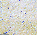 Immunohistochemical staining of MARCKS using anti-MARCKS antibody. MARCKS was detected in a paraffin-embedded section of mouse brain tissue. Heat mediated antigen retrieval was performed in EDTA buffer (pH 8.0, epitope retrieval solution). The tissue section was blocked with 10% goat serum. The tissue section was then incubated with 2 ug/ml rabbit anti-MARCKS antibody overnight at 4oC. Peroxidase Conjugated Goat Anti-rabbit IgG was used as secondary antibody and incubated for 30 minutes at 37oC. The tissue section was developed using an HRP secondary and DAB substrate.