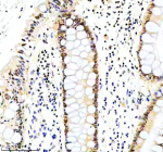 Immunohistochemical staining of ERCC5 using anti-ERCC5 antibody. ERCC5 was detected in a paraffin-embedded section of human colon tissue. Heat mediated antigen retrieval was performed in EDTA buffer (pH 8.0, epitope retrieval solution). The tissue section was blocked with 10% goat serum. The tissue section was then incubated with 2 ug/ml rabbit anti-ERCC5 antibody overnight at 4oC. Peroxidase Conjugated Goat Anti-rabbit IgG was used as secondary antibody and incubated for 30 minutes at 37oC. The tissue section was developed using an HRP secondary and DAB substrate.