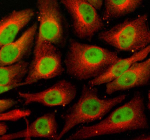 Immunofluorescent staining of ERCC5 using anti-ERCC5 antibody (green) and anti-Beta Tubulin antibody (red). ERCC5 was detected in an immunocytochemical section of Hela cells. Enzyme antigen retrieval was performed using IHC enzyme antigen retrieval reagent for 15 mins. The cells were blocked with 10% goat serum. And then incubated with 5 ug/ml rabbit anti-ERCC5 antibody and mouse anti-Beta Tubulin antibody overnight at 4oC. DyLight 488 Conjugated Goat Anti-Rabbit IgG and Cy3 Conjugated Goat Anti-Mouse IgG were used as secondary antibody at 1:500 dilution and incubated for 30 minutes at 37oC. Visualize using a fluorescence microscope and filter sets appropriate for the label used.