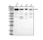 Western blot analysis of GAREM1 using anti-GAREM1 antibody. Lane 1: human SH-SY5Y whole cell lysates, Lane 2: human RT4 whole cell lysates, Lane 3: human Hacat whole cell lysates, Lane 4: human SIHA whole cell lysates. After electrophoresis, proteins were transferred to a nitrocellulose membrane at 150 mA for 50-90 minutes. Blocked the membrane with 5% non-fat milk/TBS for 1.5 hour at RT. The membrane was incubated with rabbit anti-GAREM1 antibody at 0.5 ug/ml overnight at 4oC, then washed with TBS-0.1%Tween 3 times with 5 minutes each and probed with a goat anti-rabbit IgG-HRP secondary antibody at a dilution of 1:5000 for 1.5 hour at RT. The signal was developed using enhanced chemiluminescent. GAREM1 (~96 kDa predicted) was detected as a major band at the expected size, with additional smaller bands (~55-80 kDa) consistent with proteolytic fragments or shorter isoforms reported in previous studies.