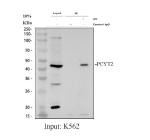 Immunoprecipitation of PCYT2 in K562 whole cell lysate. Western blot analysis of PCYT2 using anti-PCYT2 antibody; Lane 1: K562 whole cell lysates (30ug); Lane 2: Rabbit control IgG instead of anti-PCYT2 antibody in K562 whole cell lysate; Lane 3: anti-PCYT2 antibody (2ug) + K562 whole cell lysate (500ug). After electrophoresis, proteins were transferred to a membrane. Then the membrane was incubated with rabbit anti-PCYT2 antibody at a dilution of 0.5 ug/ml and probed with a goat anti-rabbit IgG-HRP secondary antibody. The signal is developed using ECL Plus Western Blotting Substrate. The expected molecular weight of PCYT2 is ~42 kDa.