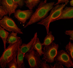 Immunofluorescent staining of PAN3 using anti-PAN3 antibody (green) and anti-Beta Tubulin antibody (red). PAN3 was detected in an immunocytochemical section of U2OS cells. Enzyme antigen retrieval was performed using IHC enzyme antigen retrieval reagent for 15 mins. The cells were blocked with 10% goat serum. And then incubated with 5 ug/ml rabbit anti-PAN3 antibody and mouse anti-Beta Tubulin antibody overnight at 4oC. DyLight 488 Conjugated Goat Anti-Rabbit IgG and Cy3 Conjugated Goat Anti-Mouse IgG were used as secondary antibody at 1:500 dilution and incubated for 30 minutes at 37oC. Visualize using a fluorescence microscope and filter sets appropriate for the label used.