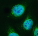 Immunofluorescent staining of PAN3 using anti-PAN3 antibody (green). PAN3 was detected in an immunocytochemical section of U2OS cells. Enzyme antigen retrieval was performed using IHC enzyme antigen retrieval reagent for 15 mins. The cells were blocked with 10% goat serum. And then incubated with 5 ug/ml rabbit anti-PAN3 antibody overnight at 4oC. DyLight 488 Conjugated Goat Anti-Rabbit IgG was used as secondary antibody at 1:500 dilution and incubated for 30 minutes at 37oC. The section was counterstained with DAPI nuclear stain (blue). Visualize using a fluorescence microscope and filter sets appropriate for the label used.