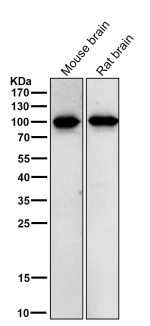 All lanes use the Phospho-Beta Catenin (Thr41/Ser45) antibody at 1:1K dilution for 1 hour at room temperature.