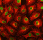 Immunofluorescent staining of TSR1 using anti-TSR1 antibody (green) and anti-Alpha Tubulin antibody (red). TSR1 was detected in an immunocytochemical section of cells. Enzyme antigen retrieval was performed using IHC enzyme antigen retrieval reagent for 15 mins. The cells were blocked with 10% goat serum. And then incubated with 5 ug/ml rabbit anti-TSR1 antibody and mouse anti-Beta Tubulin antibody overnight at 4oC. DyLight 488 Conjugated Goat Anti-Rabbit IgG and Cy3 Conjugated Goat Anti-Mouse IgG were used as secondary antibody at 1:500 dilution and incubated for 30 minutes at 37oC. Visualize using a fluorescence microscope and filter sets appropriate for the label used.