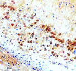Immunohistochemical staining of SNX16 using anti-SNX16 antibody. SNX16 was detected in a paraffin-embedded section of mouse brain tissue. Heat mediated antigen retrieval was performed in EDTA buffer (pH 8.0, epitope retrieval solution). The tissue section was blocked with 10% goat serum. The tissue section was then incubated with 2 ug/ml rabbit anti-SNX16 antibody overnight at 4oC. Peroxidase Conjugated Goat Anti-rabbit IgG was used as secondary antibody and incubated for 30 minutes at 37oC. The tissue section was developed using an HRP secondary and DAB substrate.